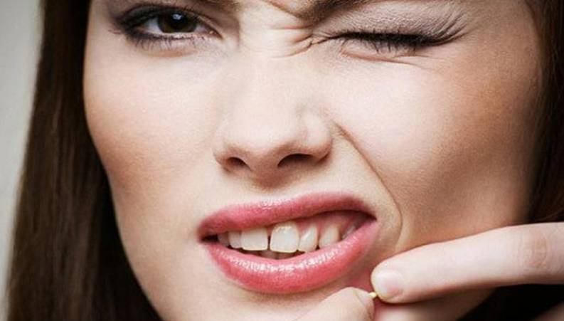 با این روش ها از جوش صورت خلاص شوید!