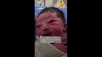 نوزاد سبیلو و واکنش‌های عجیب فضای مجازی به چهره‌ی بزرگسال