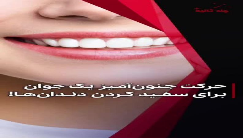 حرکت جنون‌آمیز یک جوان برای سفـید کـردن دندان‌هایش ۱۷ میلیون بار دیده شد