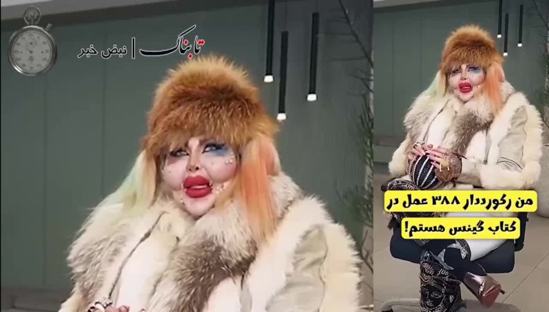 این زن ایرانی رکوردار عمل جراحی زیبایی در گینس است