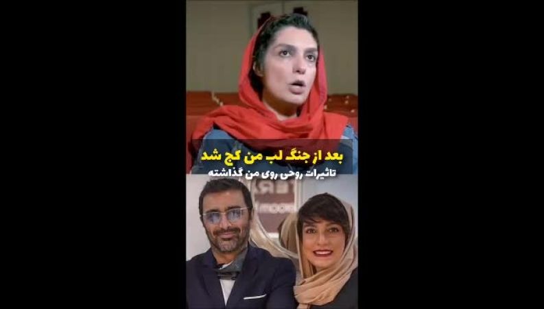 الیکا عبدالرزاقی: بعد از جنگ دهانم کج شد