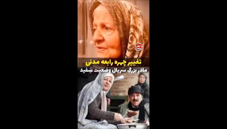 تغییر چهره چشمگیر بازیگر «وضعیت سفید» بعد از سال‌ها! 